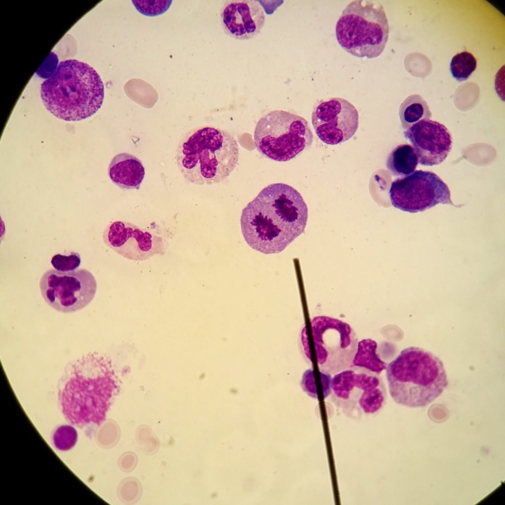 Microscope shot of a cell undergoing mitosis